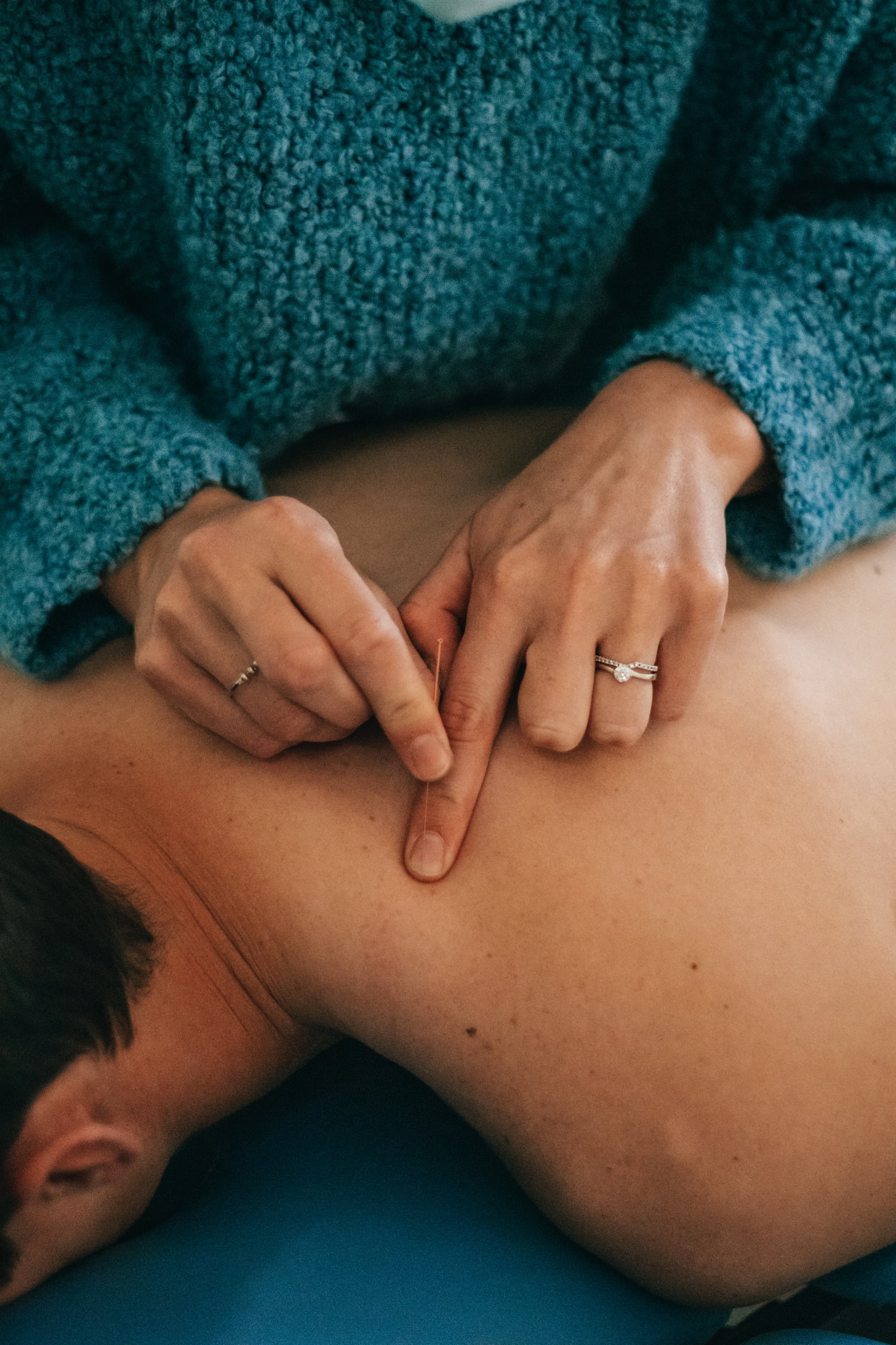 Kinesist die een patiënt behandelt met dry needling